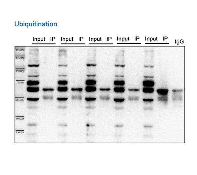 蛋白質泛素化(Ub)修飾